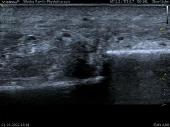 Sonografie1